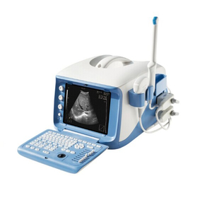 מכונת אבחון אולטרסאונד 4D ניידת של בית חולים (MT01006101)